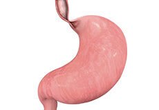 achalasia-4880839
