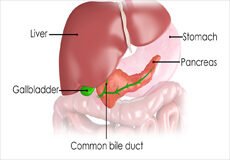 biliary-tract-disease-3493475