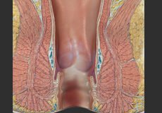 colorectal-7110429