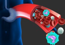 eosinophilia-eosinophil-associated-5378665