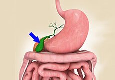 gallbladder-disease-1969395