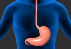 gastric-disease-5457787