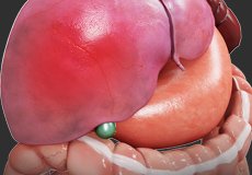 hepatitis