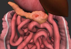 pancreas-5478899