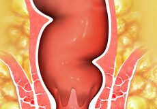 rectum-3188639